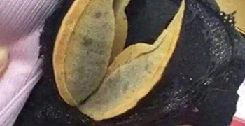 內衣發霉怎么辦？霉博來士教你除霉措施！